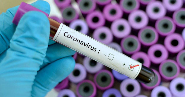 تحاليل فيروس كورونا